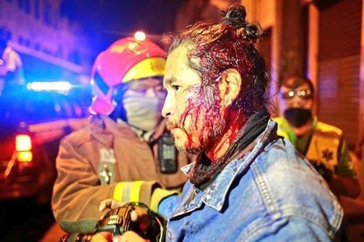 Fotoperiodista Carlos Sebastián después de ser golpeado por un agente de la Policía Nacional
